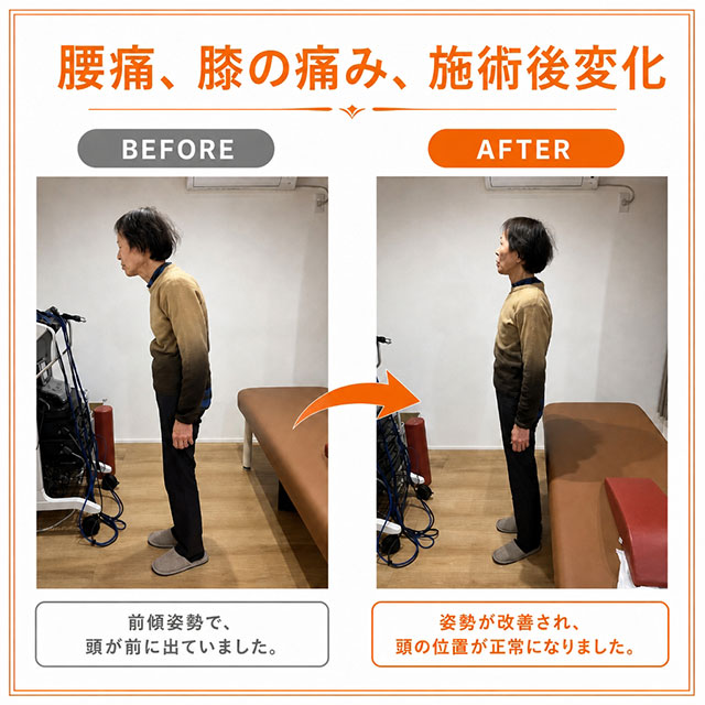 腰痛・膝痛施術後ビフォーアフター