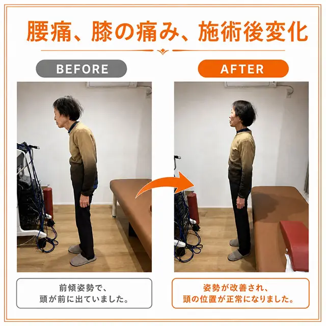 腰痛・膝痛施術後ビフォーアフター