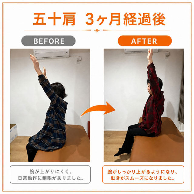 こくあ接骨院で施術したお客様のビフォーアフター